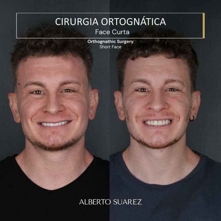 Instagram post from dralbertosuarez. This post is in position 14.